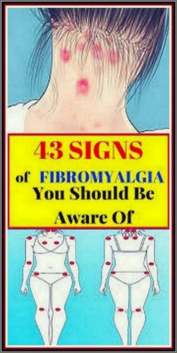 43 Signs of Fibromyalgia You Should Be Aware Of