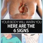 One Month Before a Heart Attack, Your Body Will Warn You – Here Are the 6 Signs