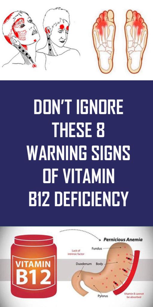 Don’t Ignore These 8 Warning Signs of Vitamin B12 Deficiency