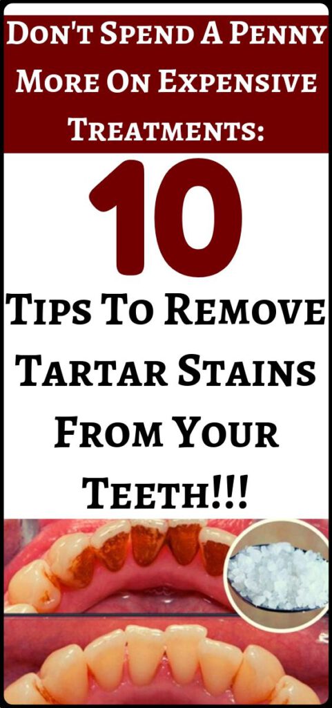 Naturally Whiten Teeth: 10 Ways to Remove Tartar Stains from Your Teeth