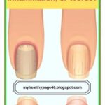 This Is What Your Fingernails are Warning You About: Organ Failure, Inflammation, or Worse
