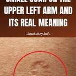 This Is The Truth Behind the Scar Everyone Has on the Upper Left Arm