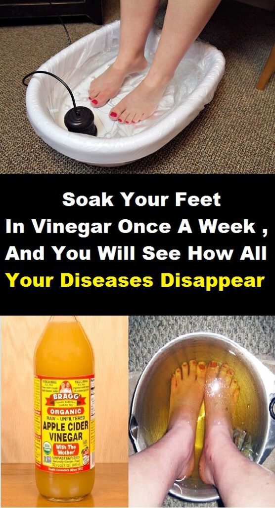Soak Your Feet in Vinegar Once a Week and You Will See How All Your Diseases Disappear