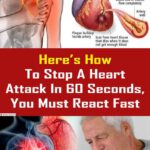 Here’s How To Stop A Heart Attack In 60 Seconds, You Must React Fast