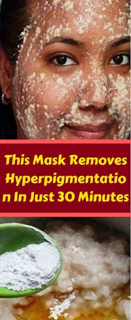 No More Hyperpigmentation, Dark Spots and Stains: This Mask Removes All Them!