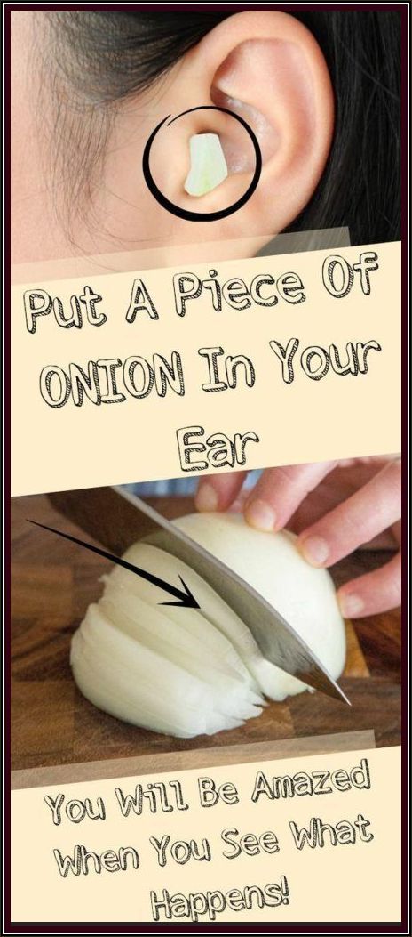 When You Put a Piece of Onion In Your Ear Result Will Be Amazing