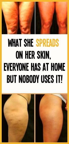 What She Spreads On Her Skin, Everyone Has At Home