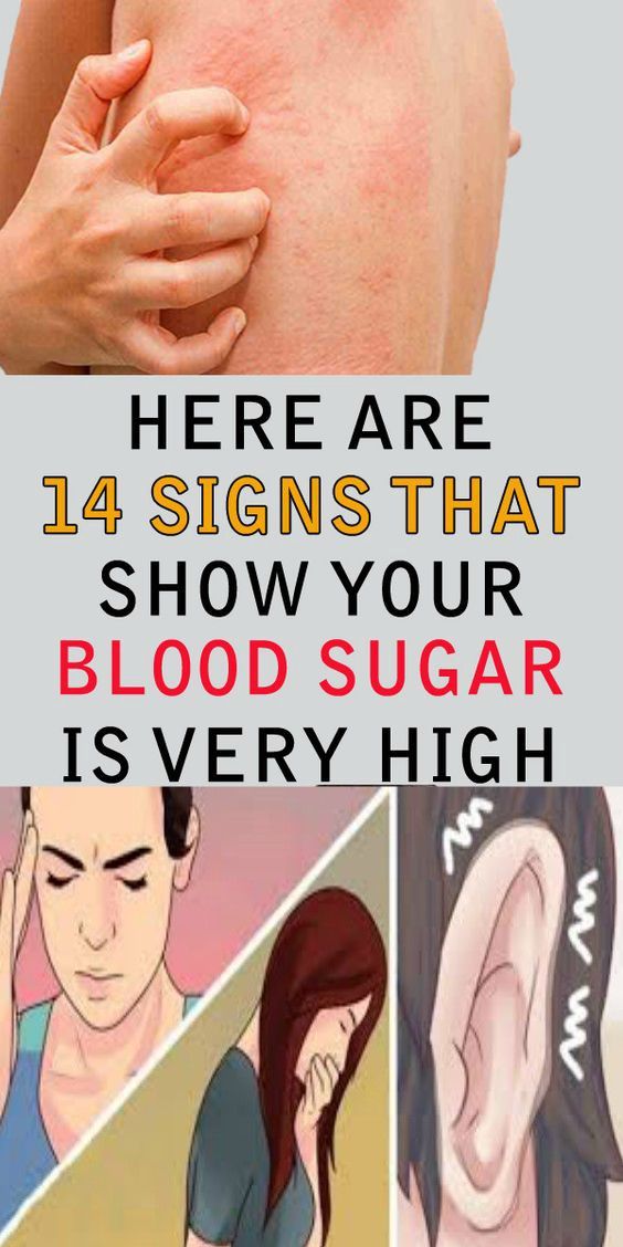 14 Signs Showing That Your Blood Sugar Is Very High