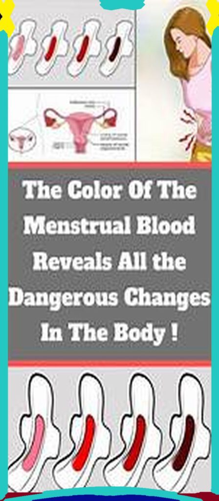 Look At Your Menstrual Pad! Your Health Might Be In Danger!