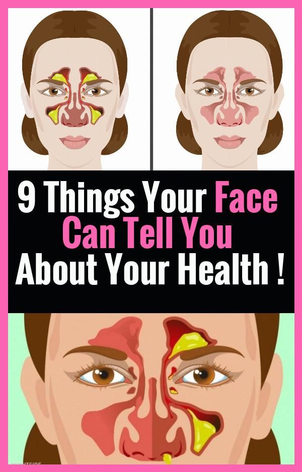 A Sign Your Face Sends When You Are Not Healthy!