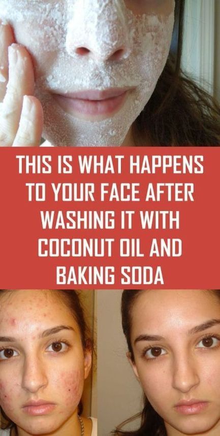 This Is What Happens to Your Face After You Wash It With Coconut Oil and Baking Soda