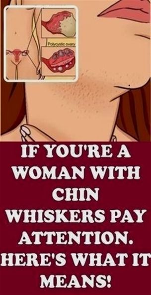 If You Are a Woman With Chin Whiskers