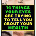 14 Things Your Eyes Are Trying to Tell You About Your Health