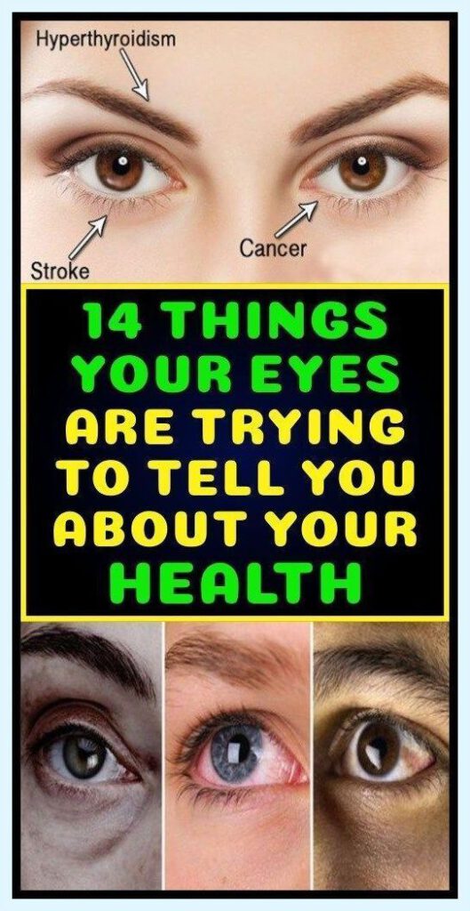 14 Things Your Eyes Are Trying to Tell You About Your Health