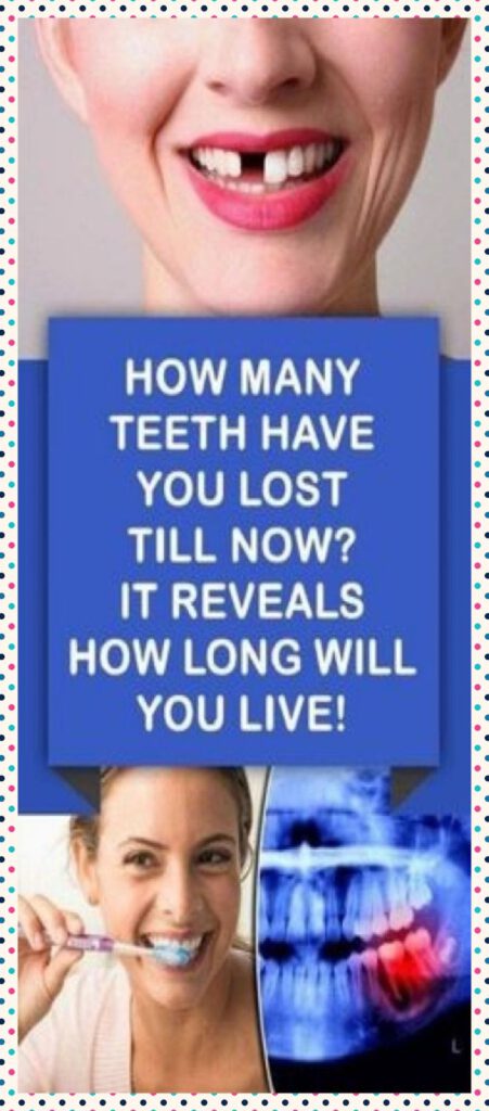 How Many Teeth Have You Lost So Far? It Tells You How Long You Will Live
