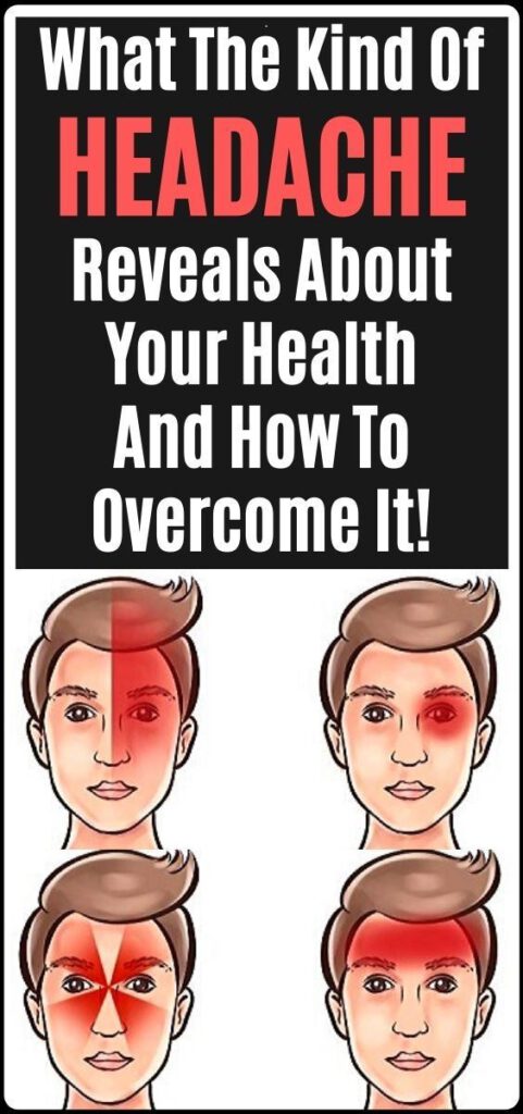 What The Kind of Headache Reveal About Your Health