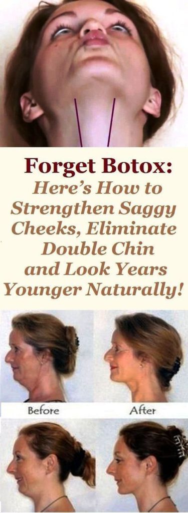 Forget Botox: Here’s How to Strengthen Saggy Cheeks