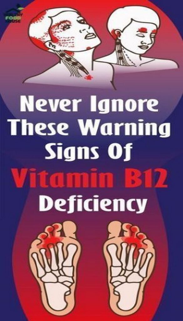 Never Ignore These Warning Signs of Vitamin B12 Deficiency