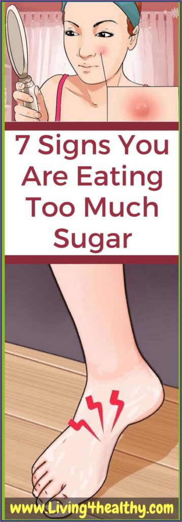 Just 7 Signs You Are Eating, Too Much Sugar!
