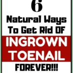 Treat Your Ingrown Toenail With These 6 Natural & Homemade Remedies