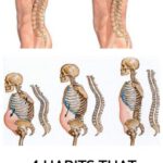 4 Habits That Prevent & Treat The Dreaded ‘dowager’s Hump’