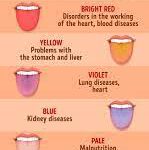Find Out What Your Tongue Is Trying to Tell You