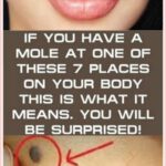 If You Have a Mole At One of These 7 Places On Your Body This Is What It Means