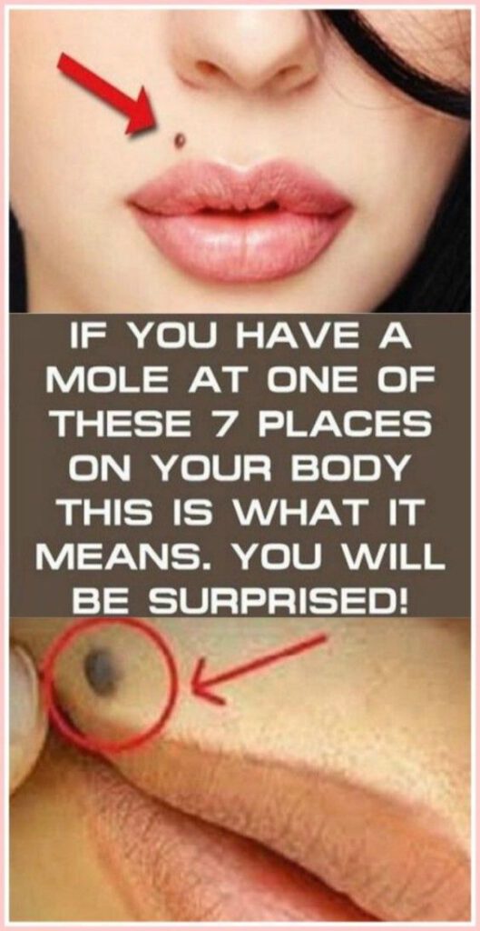 If You Have a Mole At One of These 7 Places On Your Body This Is What It Means