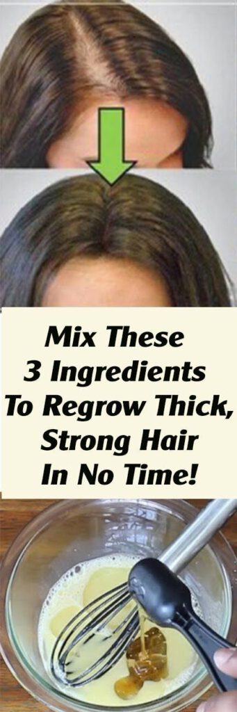 Mix These 3 Ingredients to Regrow Thick, Strong Hair In No Time!
