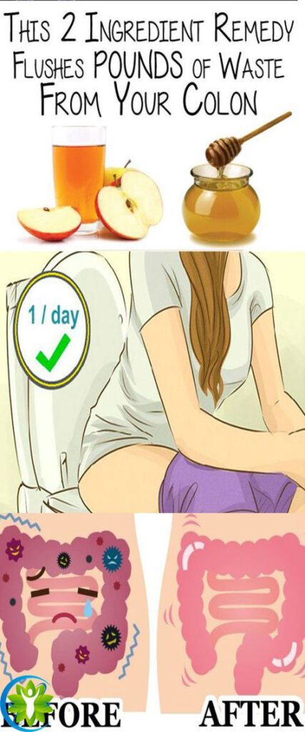 Method to Remove 20 Pounds of Toxins From Your Colon with Only Two Ingredients